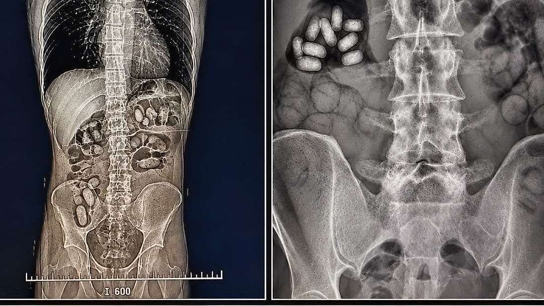 İzmir Havalimanı’nda, yuttukları 495 gram metamfetamin ele geçirildi