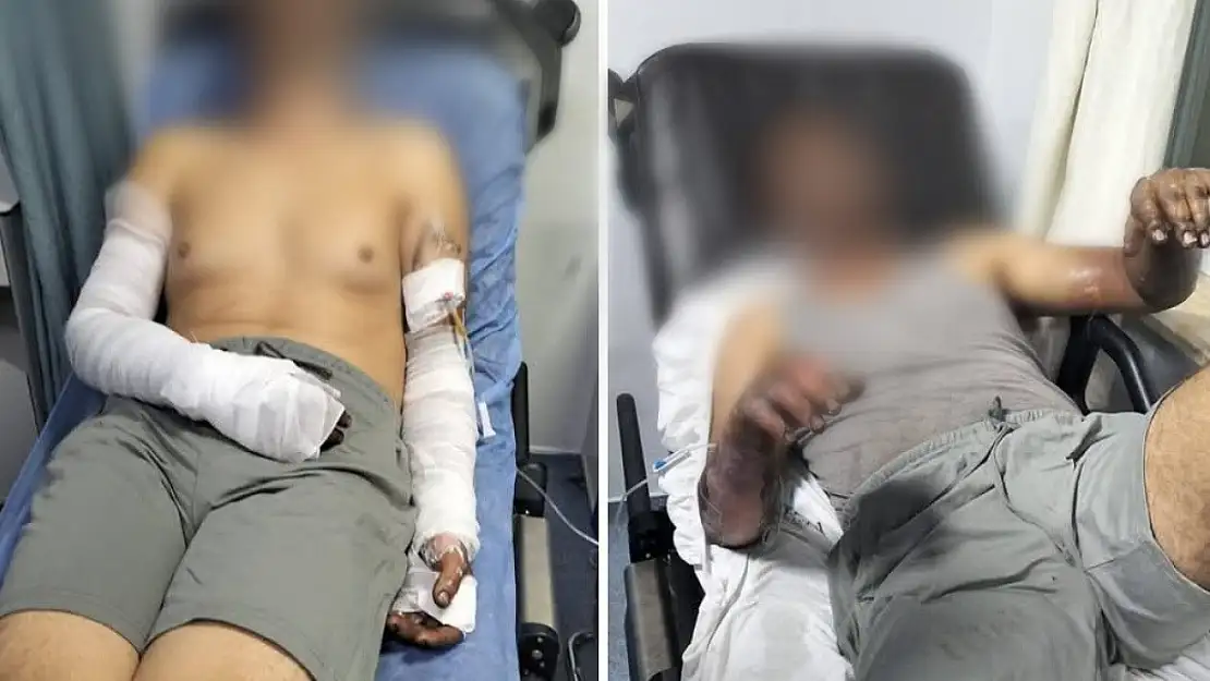 Sanayi sitesinde patlama: 2 yaralı