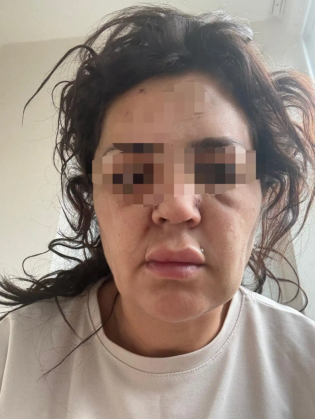 Bornova Belediyesi zabıtasından kadına işkence…