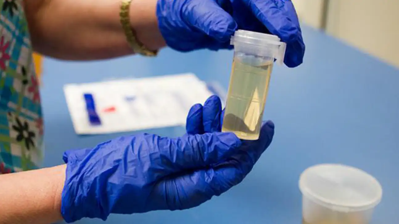 Yasaklı madde testleri hakkında toplumda yaygın olan yanlış bilgiler