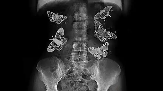 Aşk karnımızda kelebekler uçuruyor mu?