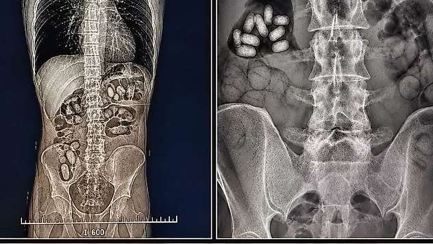 İzmir Havalimanı'nda, yuttukları 495 gram metamfetamin ele geçirildi