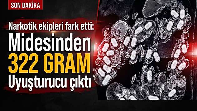 Narkotik ekipleri fark etti: Midesinden 322 gram uyuşturucu çıktı