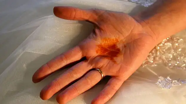 Sabah elde beliren kına benzeri izler merak uyandırıyor