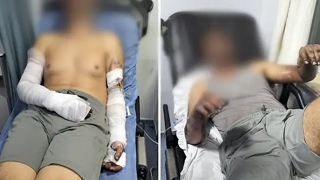 Sanayi sitesinde patlama: 2 yaralı