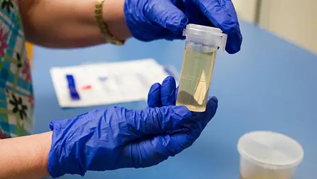 Yasaklı madde testleri hakkında toplumda yaygın olan yanlış bilgiler