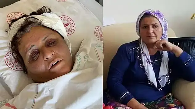 Yufka tartışması kötü bitmişti: 11 gün sonra taburcu edildi