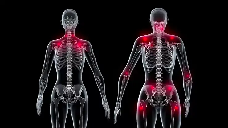 Mükemmeliyetçilik fibromiyaljiyi tetikliyor!