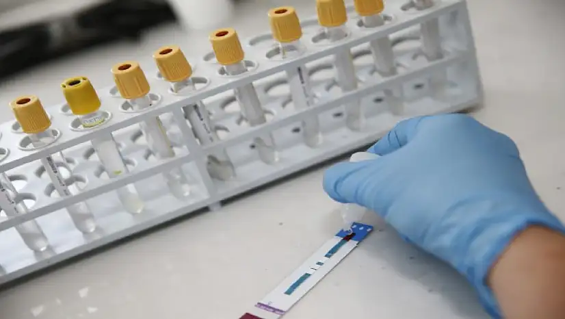 İzmir'de kimliksiz ve ücretsiz HIV testi dönemi başladı