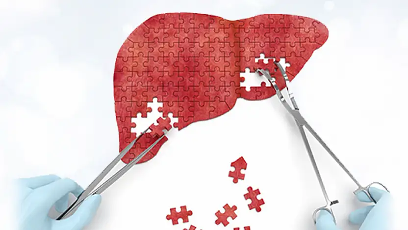 28 Temmuz dünya hepatit günü: DSÖ 2030 hedefine kararlı adımlarla ilerliyor