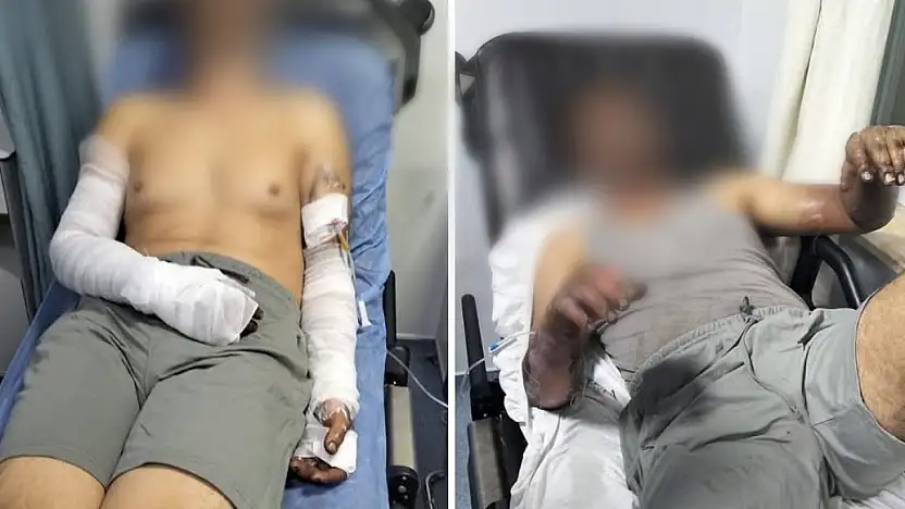 Sanayi sitesinde patlama: 2 yaralı