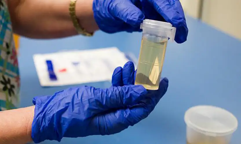 Yasaklı madde testleri hakkında toplumda yaygın olan yanlış bilgiler